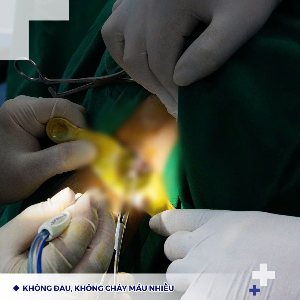 Không đau không chảy máu nhiều