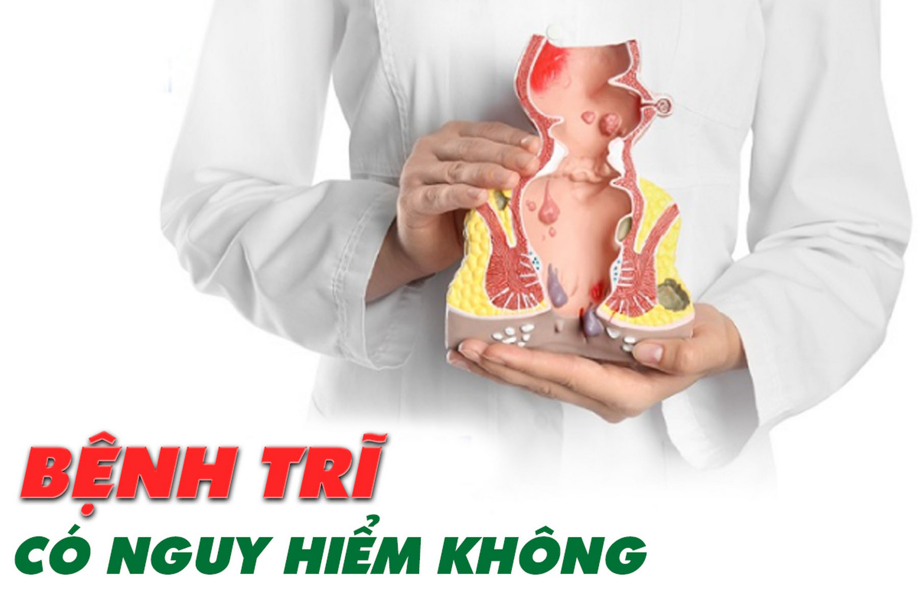 Bệnh trĩ có nguy hiểm không