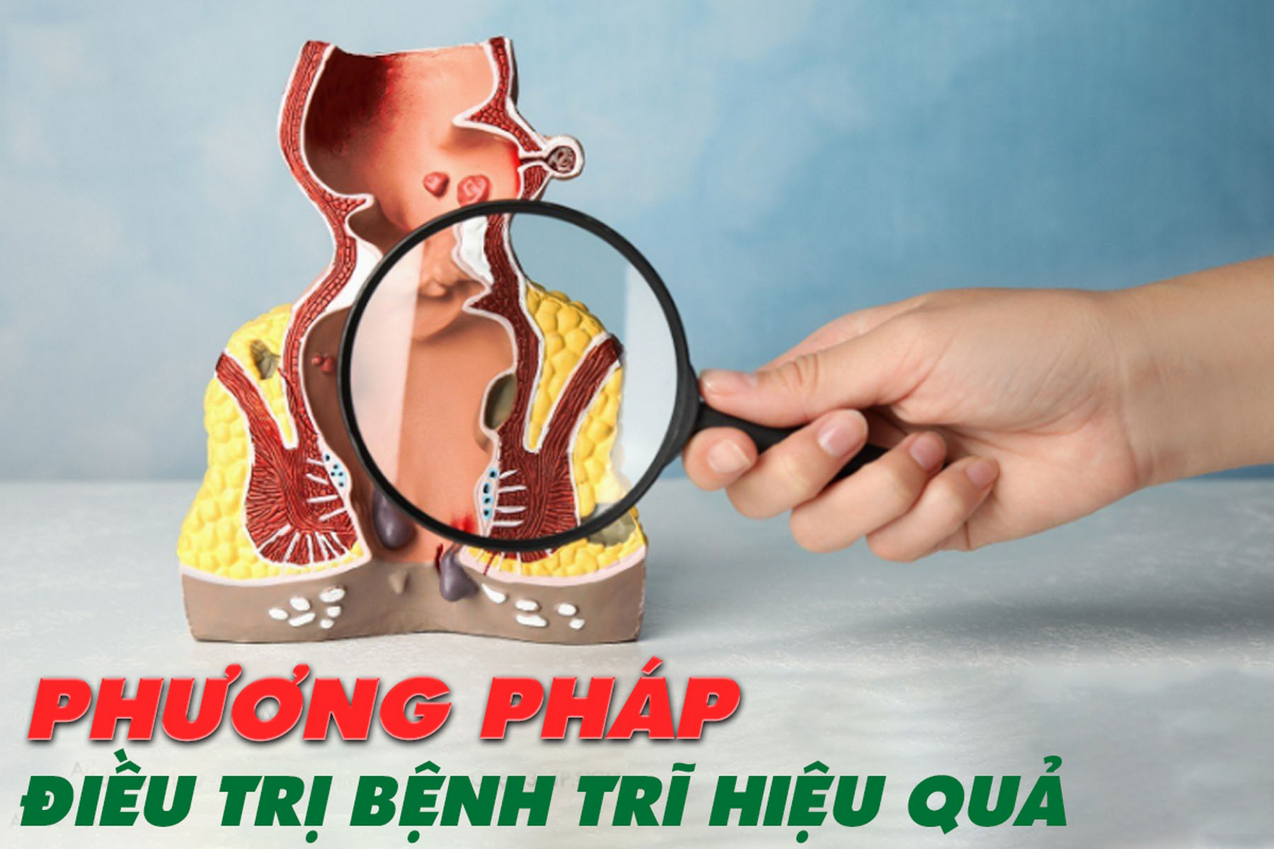Phương Pháp Điều Trị Bệnh Trĩ Hiệu Quả