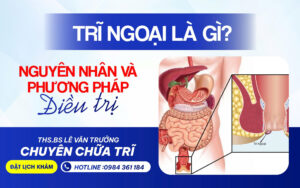 trĩ ngoại là gì