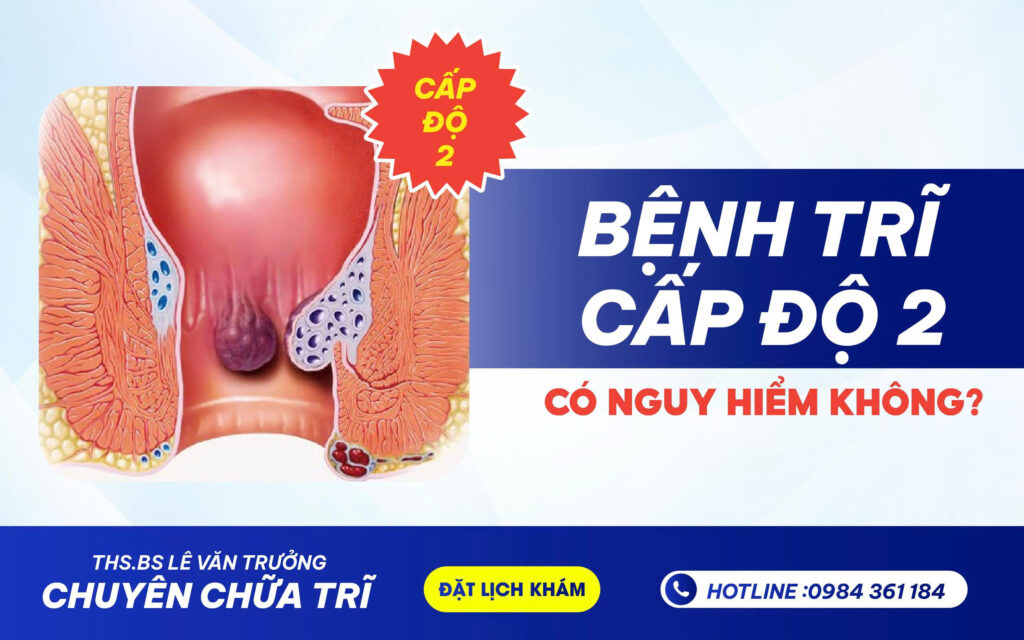 BỆNH TRĨ CẤP ĐỘ 2 CÓ NGUY HIỂM KHÔNG