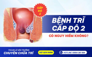 BỆNH TRĨ CẤP ĐỘ 2 CÓ NGUY HIỂM KHÔNG