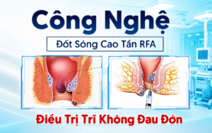sóng cao tần rfa